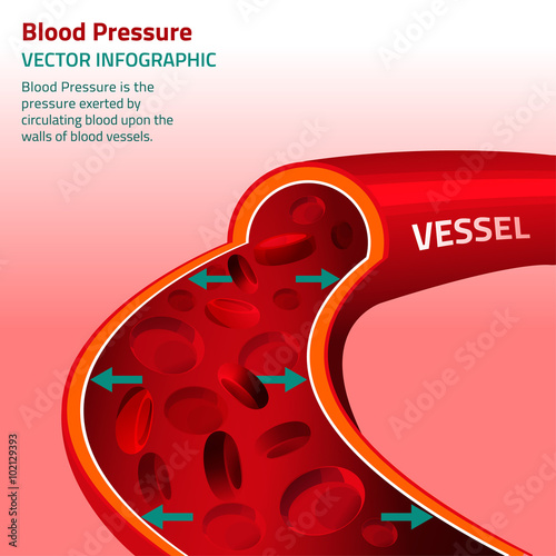 Blood Pressure Infographic