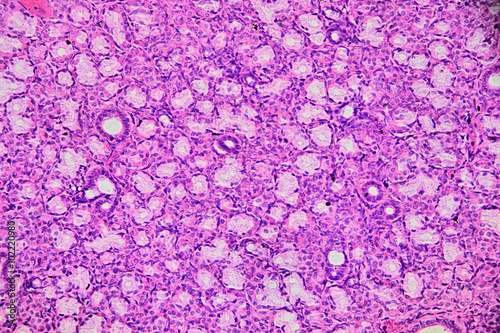 Human salivary gland - microscopic image photo