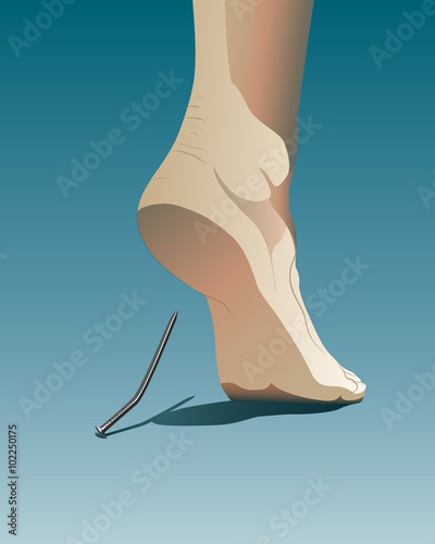 Vulnerability - Achilles Heel.
Human heel injured by metal nail. Symbolizing vulnerability, weakness, weak point.