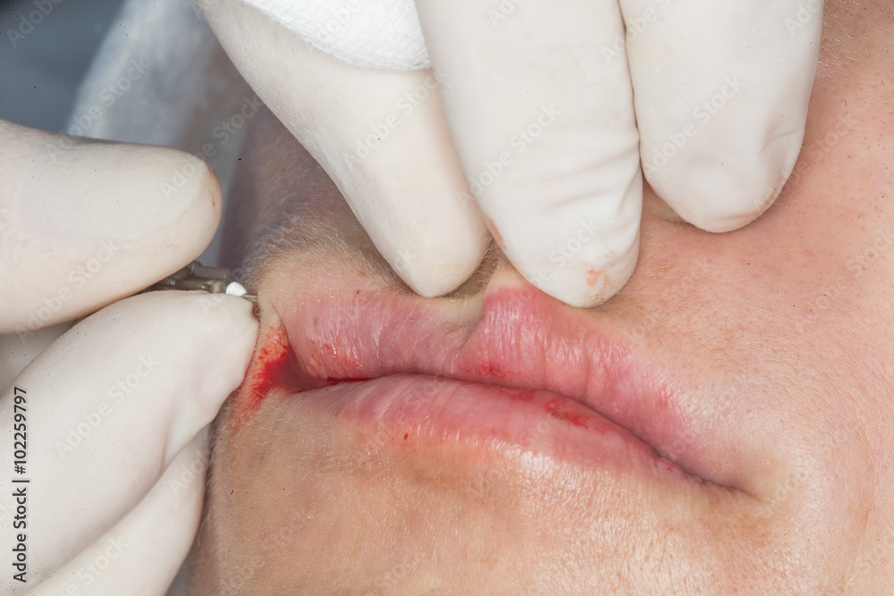 Naklejka premium Photo of cosmetic procedures .