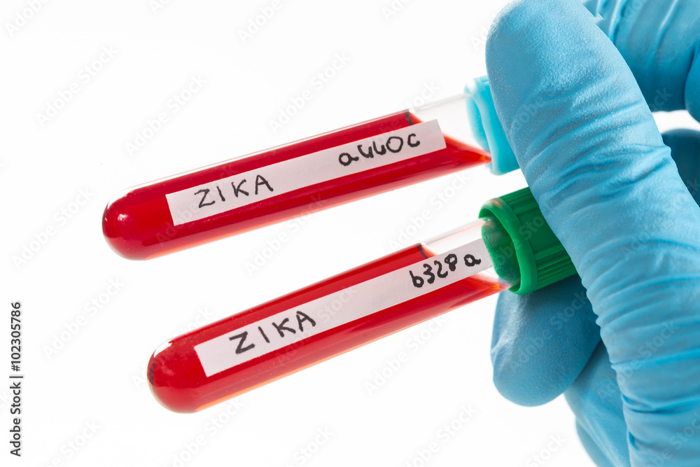 Fototapeta premium Virus Zika