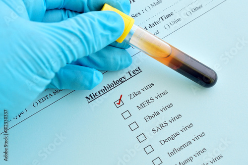 Foto Zika virus test