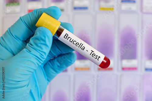 Blood sample for Brucella bacteria infected test
 photo