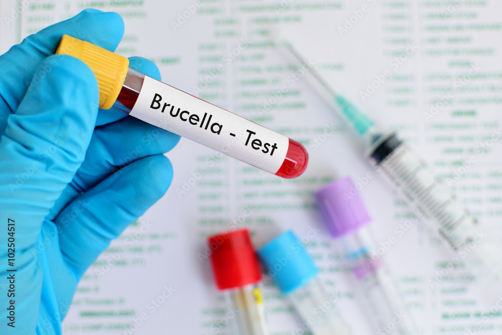 Obraz premium Blood sample for Brucella bacteria infected test 