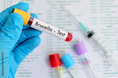 Blood sample for Brucella bacteria infected test
 photo