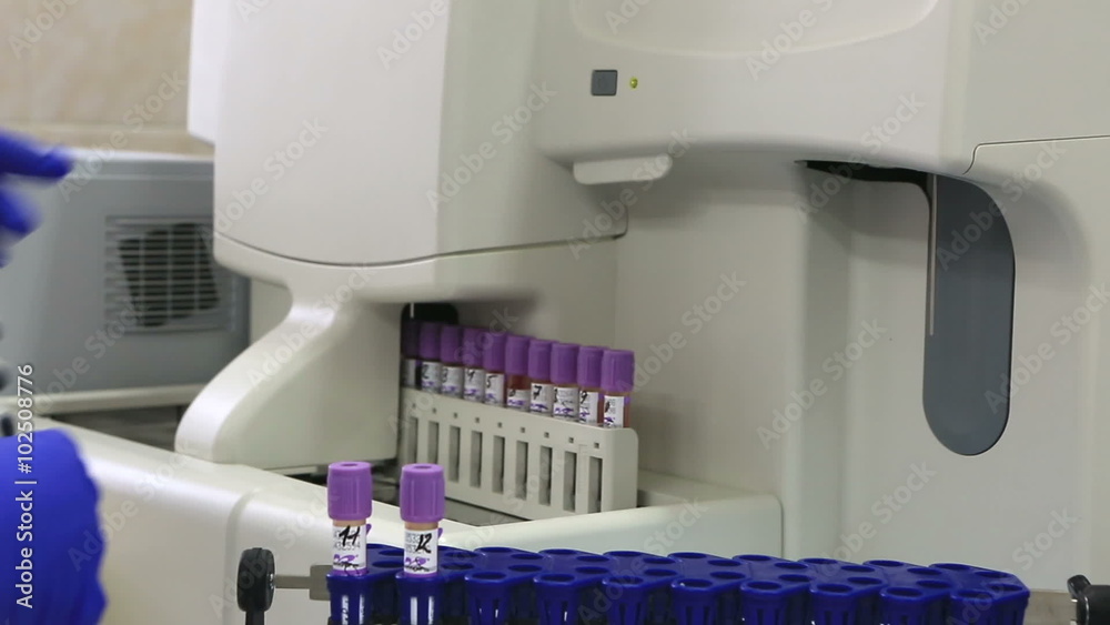 Modern high-performance automatic hematology analyzer with autoloader.
