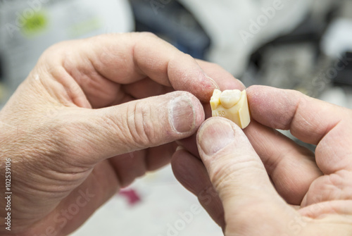 Male Dental Technician Working On A 3D Printed Mold For Tooth Implants In The Lab.