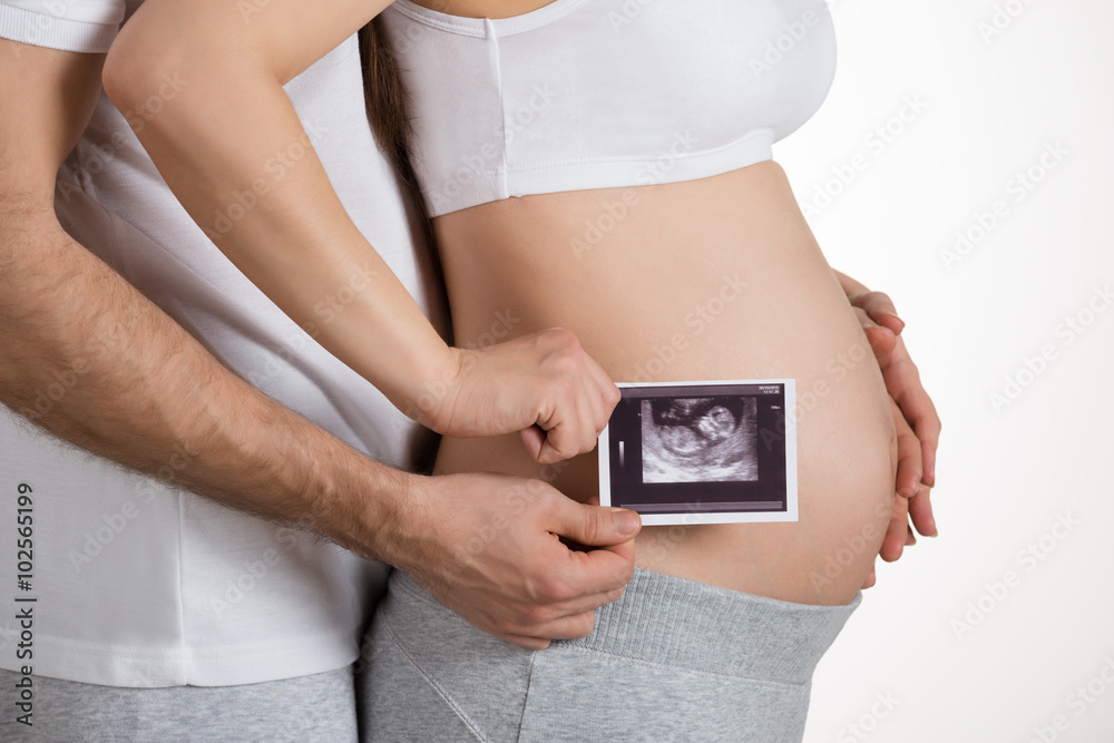 Expecting Couple Showing X-ray Expecting Couple Showing X-ray