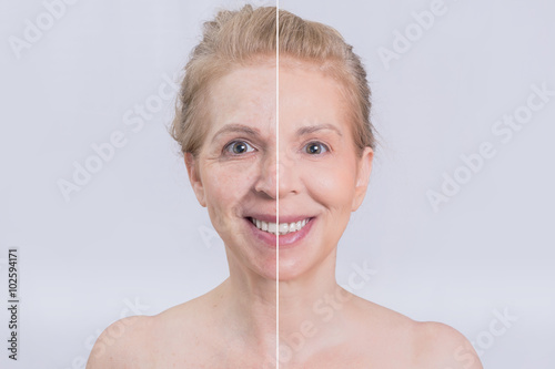 Before and after skin treatment transformation 