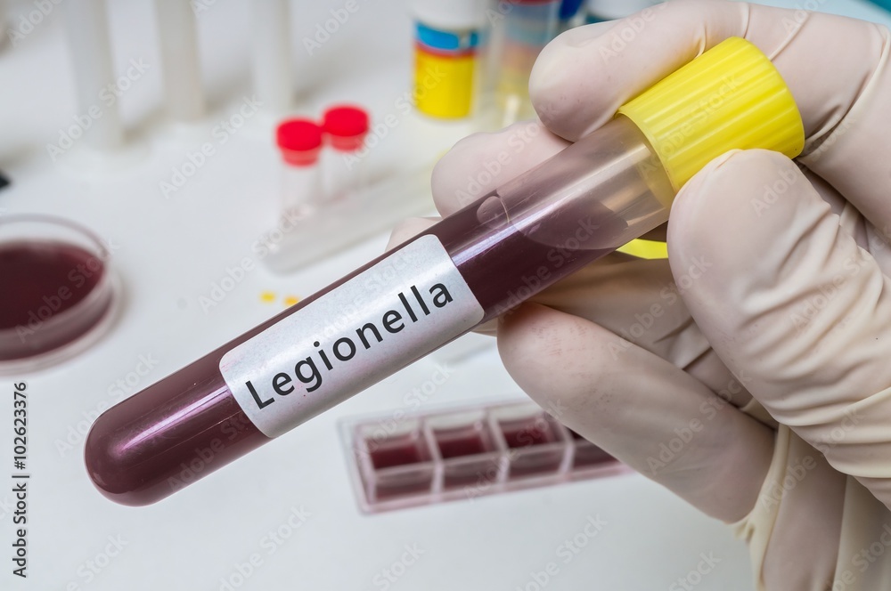 Hand of researcher holds test tube with blood for Legionella test Hand of researcher holds test tube with blood for Legionella test