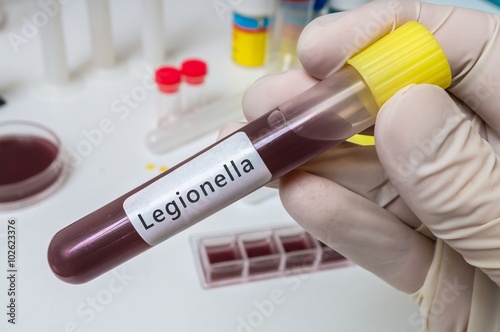 Fotografie Hand of researcher holds test tube with blood for Legionella test