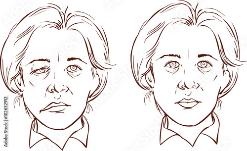 white background vector illustration of a  facial lopsided illus