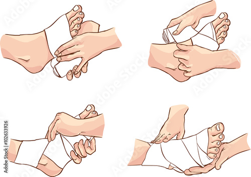 Vector illustration of a  medical foot bandage technique