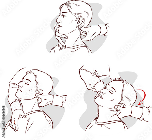 Vector illustration of a Gonstead Chiropractic for acute neck pa