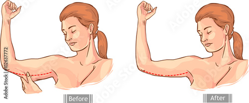white background vector illustration of a loose handle