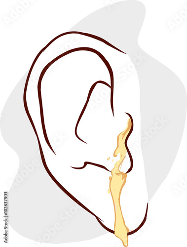 blue background vector illustration of a ear infection