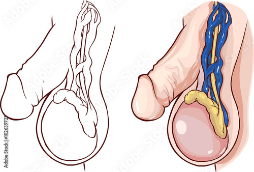 white background vector illustration of a  Varicocele