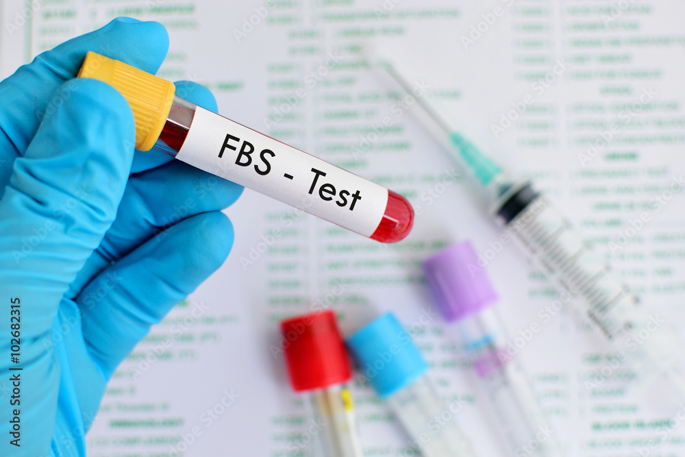 Fasting blood sugar (FBS) test Fasting blood sugar (FBS) test