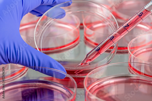 Changing medium of cells cultured in petri dishes