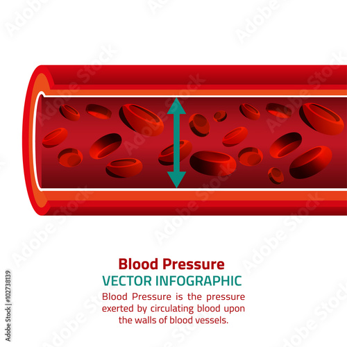 Blood Pressure Infographic