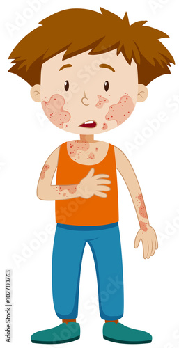 Boy with infectious disease