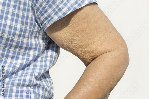 Elderly woman wrinkled skin upper arm