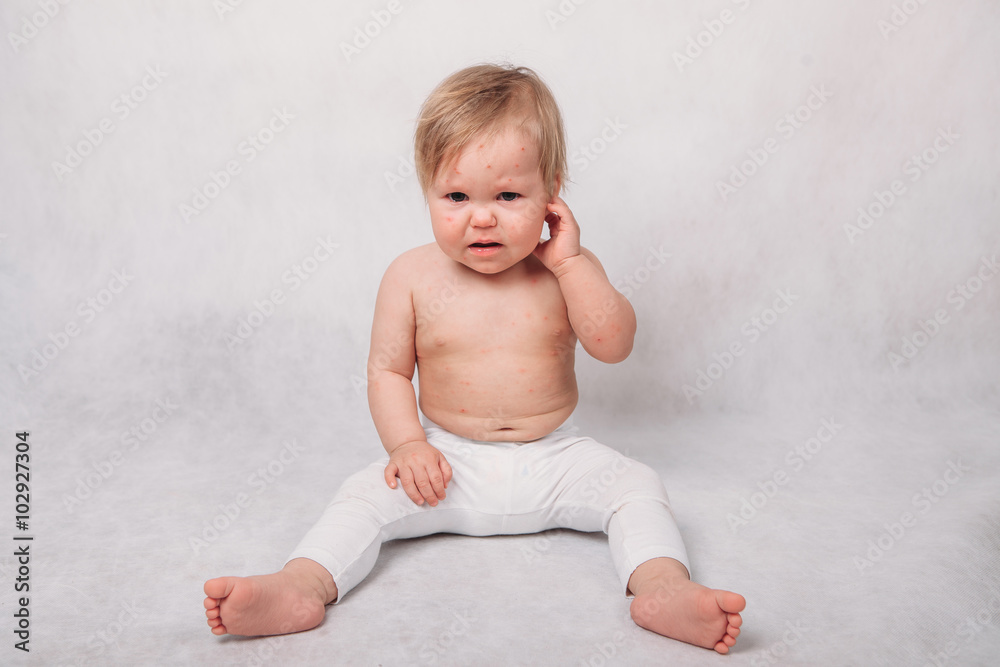 Sick baby Sick baby