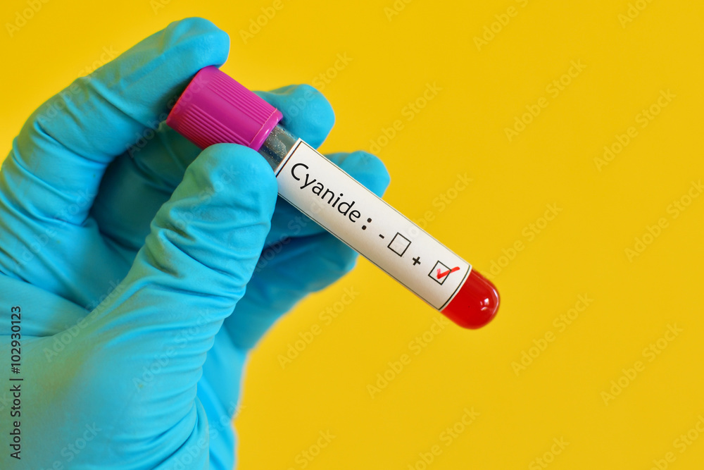 Obraz premium Blood sample positive with cyanide chemical testing