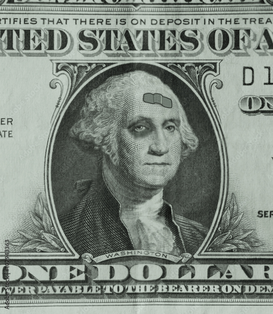 George Washington on a dollar bill is sporting a black eye and a band