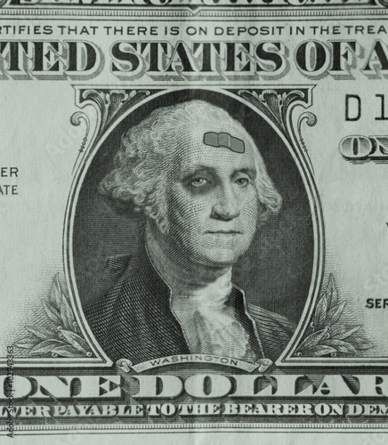 George Washington on a dollar bill is sporting a black eye and a band-aid, as the weak dollar takes a beating.