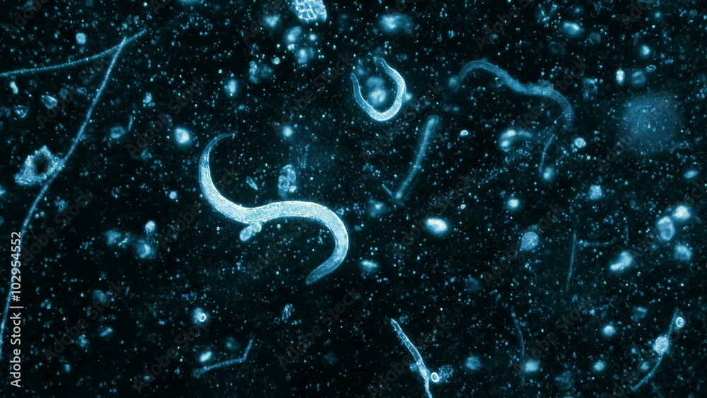Three Nematode Worms Seen In Dark Field Microscope With Blue Filter 200x