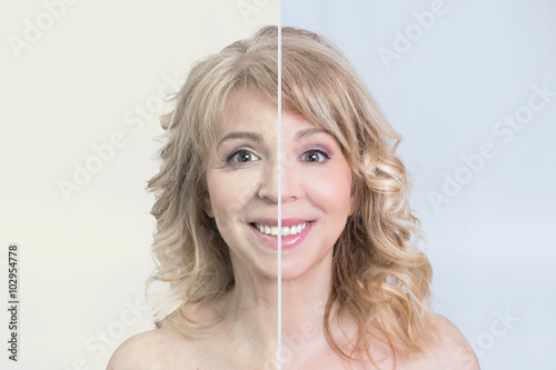 Before and after skin treatment transformation of a mid aged blonde woman smiling 