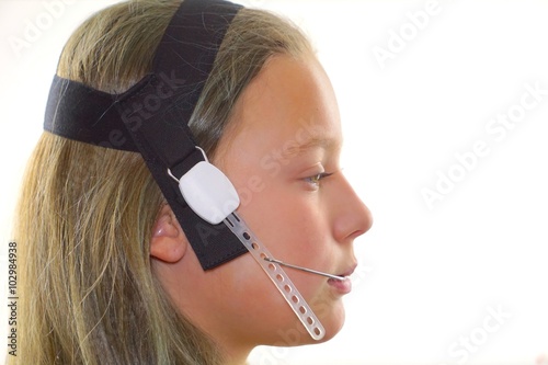 Mädchen mit großer Zahnspange von der Seite, Porträt mit Zahnklammer. Zahnmedizinische Maßnahme und Kieferorthopädie