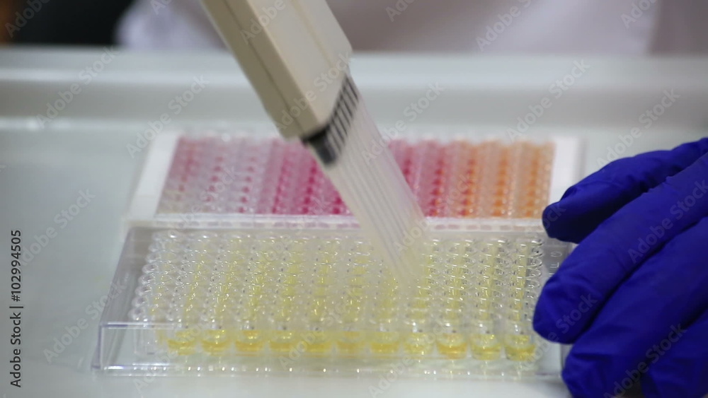 ELISA antibody selection. ELISA antibody selection.