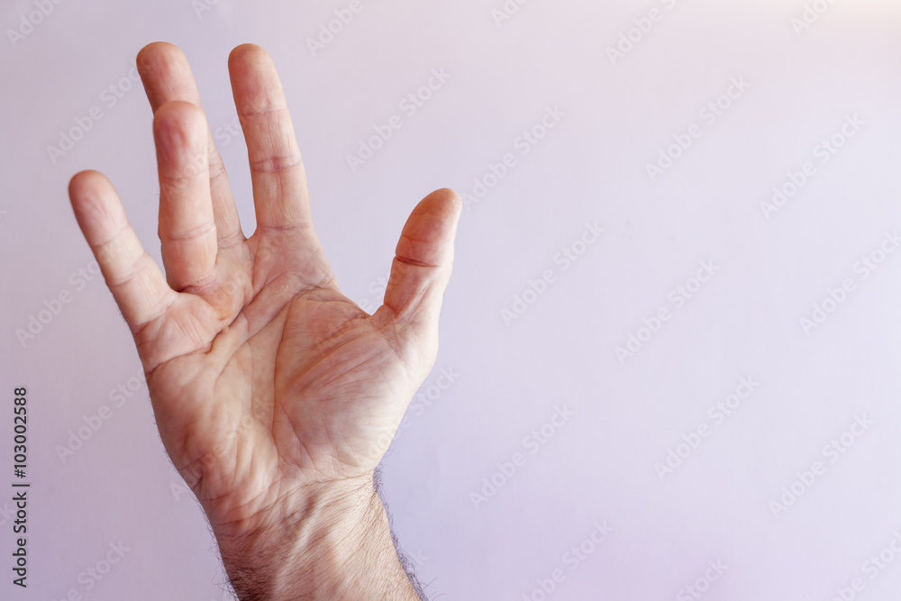Hand of an man with Dupuytren contracture  disease, against  bright background, isolated 