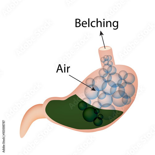 Belching. Air in the stomach. The structure of the esophagus and stomach. Infographics. Vector illustration