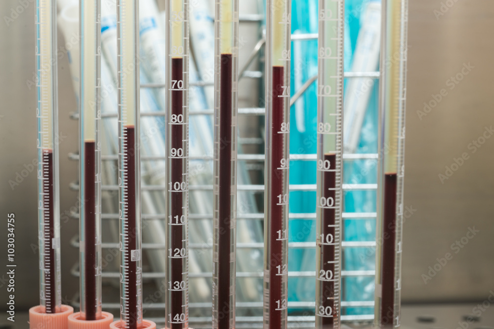 Obraz premium Laboratorio di analisi del sangue