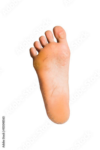foot on white background © meen_na