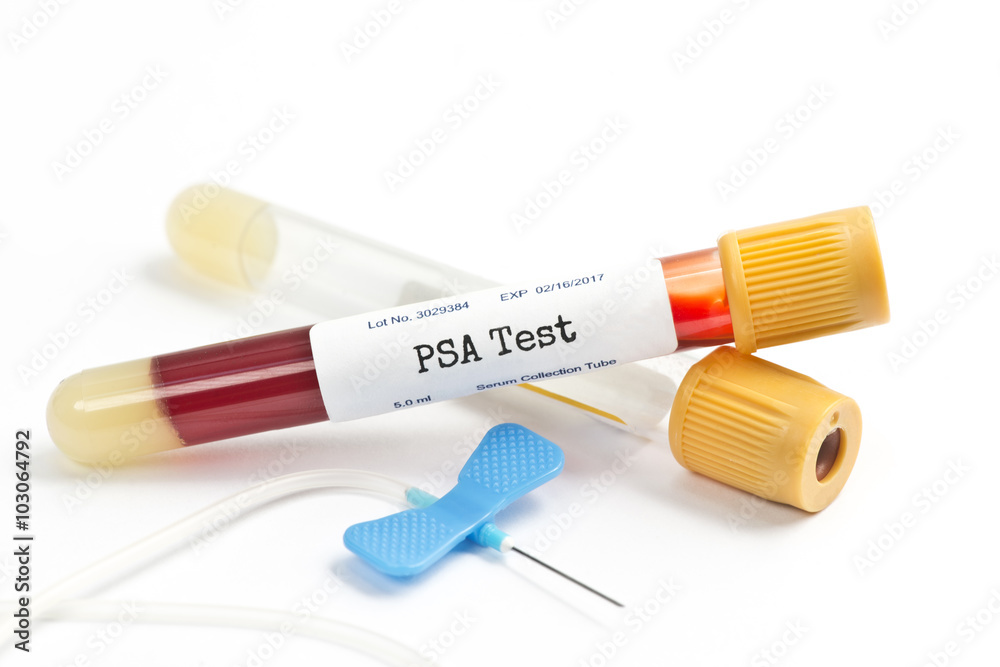 PSA Test PSA Test