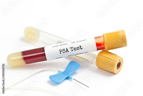 PSA Test photo