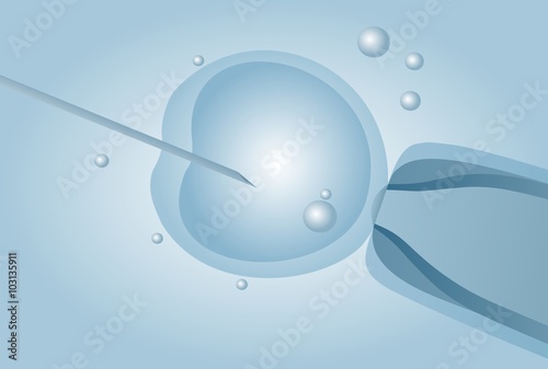 Microscopic artificial insemination, In vitro fertilisation IVF