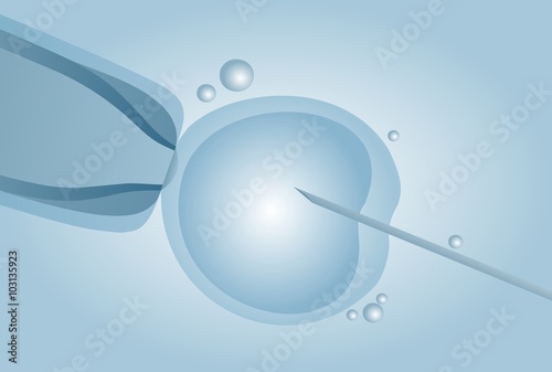 Microscopic artificial insemination, In vitro fertilisation IVF