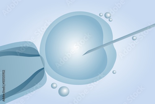 Microscopic artificial insemination, In vitro fertilisation (IVF