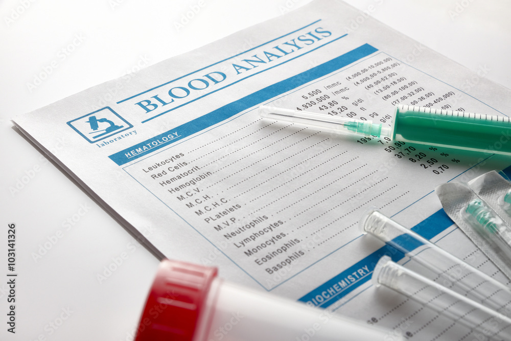Blood test report with vials urine container and syringe Blood test report with vials urine container and syringe