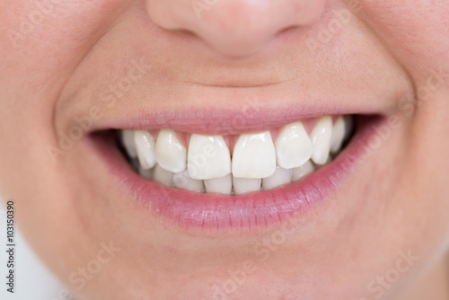 Female Smiling With Healthy White Teeth