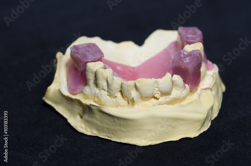 Dental model with teeth made in wax on black background.
