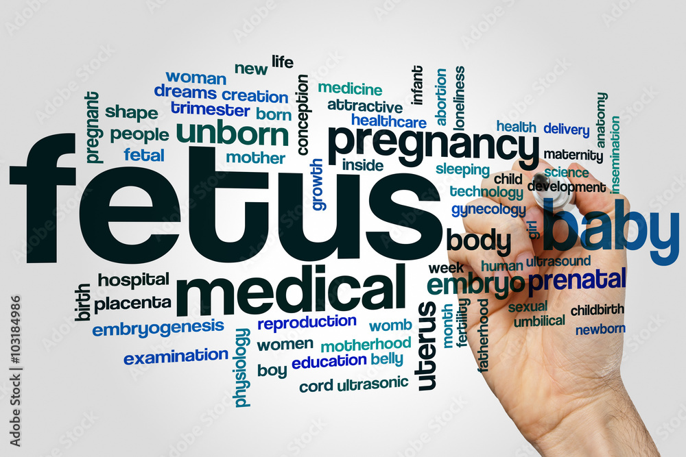 Fetus word cloud Fetus word cloud