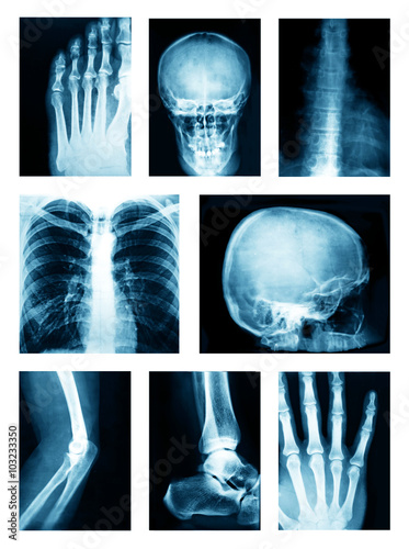 Collage of many X-rays