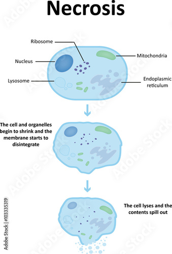 Necrosis Diagram