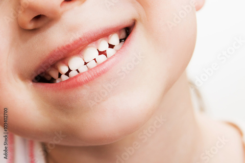 baby smile close. child teeth on a white isolated background. photo